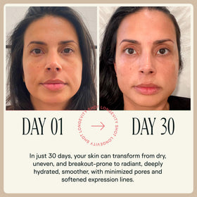 Happy Aging Liquid NAD+ Resveratrol Supplement showing multiple shots