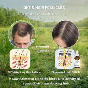 Ingredients list of PHYTO LIFE Pure Saw Palmetto Oil
